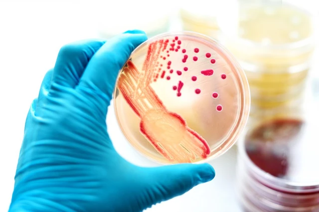 Nguyên nhân và biến chứng khi bị hội chứng nhiễm trùng