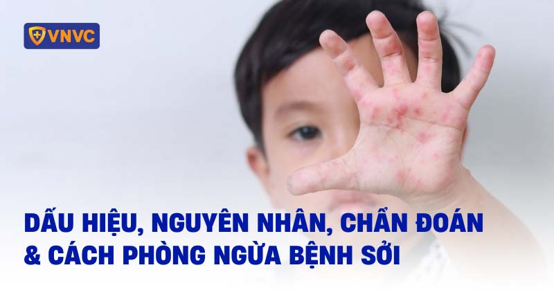 Bệnh Sởi: Nguyên Nhân, Triệu Chứng, Cách Phòng Ngừa và Điều Trị Hiệu Quả